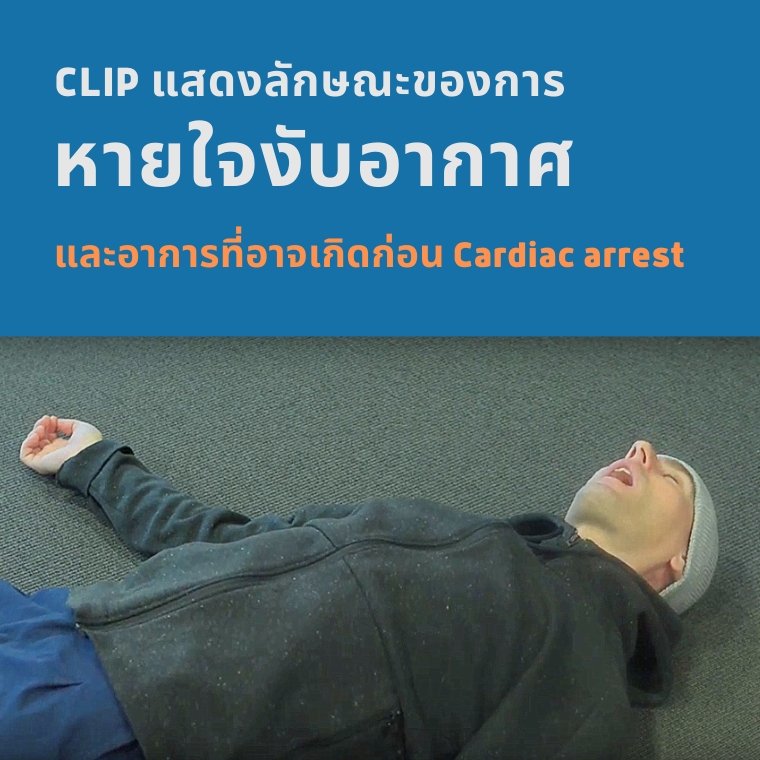 หายใจงับอากาศ อาการที่บอกคุณว่าต้องเริ่มทำ CPR คนๆนั้นได้แล้ว