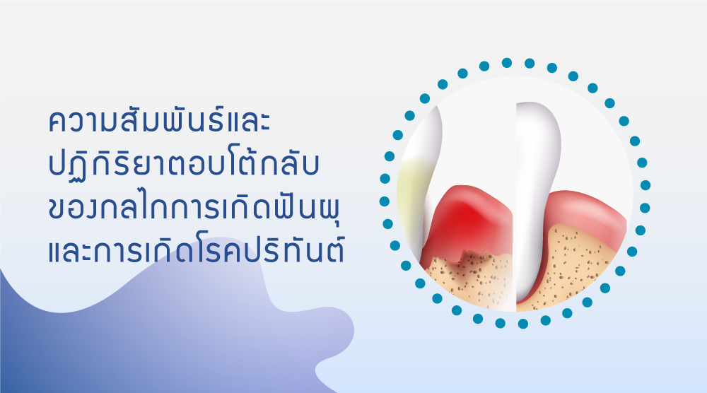 ความสัมพันธ์และปฏิกิริยาตอบโต้กลับของกลไกการเกิดฟันผุและกลไกการเกิดโรคปริทันต์  ความสัมพันธ์และปฏิกิริยาตอบโต้กลับของกลไกการเกิดฟันผุและกลไกการเกิดโรคปริทันต์