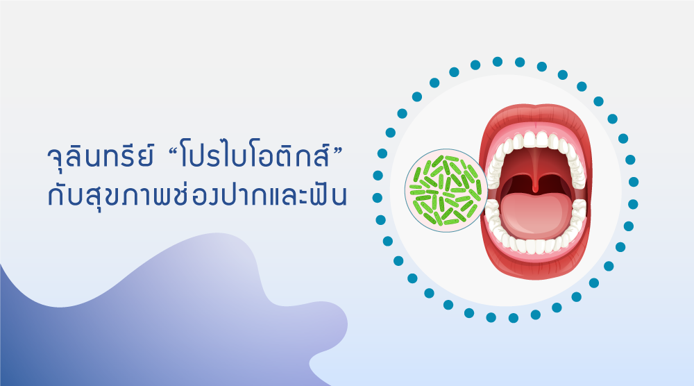 จุลินทรีย์ โปรไบโอติกส์ สุขภาพช่องปากและฟัน จุลินทรีย์ โปรไบโอติกส์ สุขภาพช่องปากและฟัน