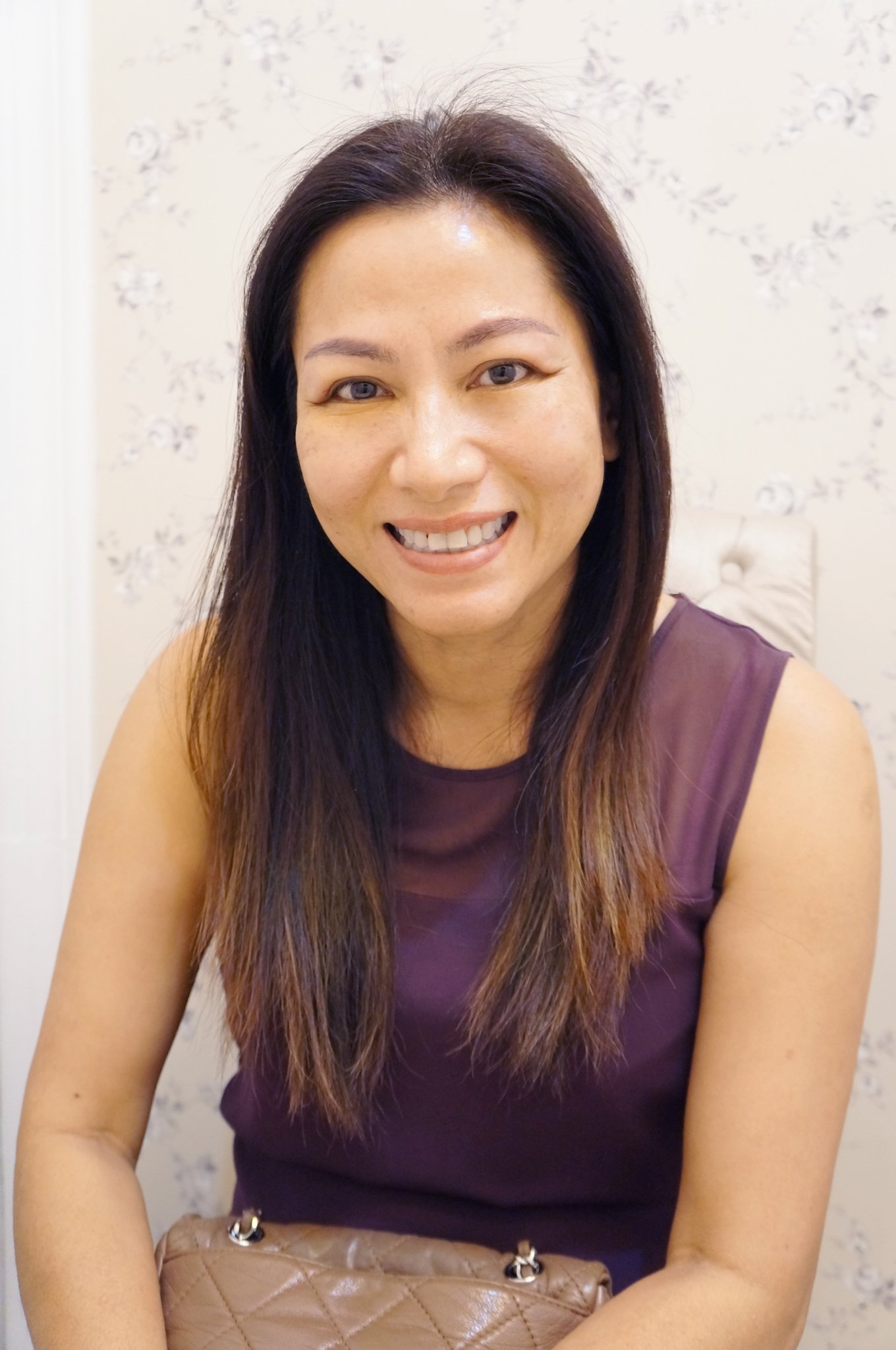 หลายคนทักว่าหน้าเด็กลง ดูดีขึ้น เราก็แอบยิ้มในใจเบาๆ “ที่สำคัญคุณหมอมือเบามากไม่เจ็บเลย” ประสบการณ์ตรงของ คุณกุ๊ก อายุ 49 ปี จาก ภูเก็ต  หลายคนทักว่าหน้าเด็กลง ดูดีขึ้น เราก็แอบยิ้มในใจเบาๆ “ที่สำคัญคุณหมอมือเบามากไม่เจ็บเลย” ประสบการณ์ตรงของ คุณกุ๊ก อายุ 49 ปี จาก ภูเก็ต