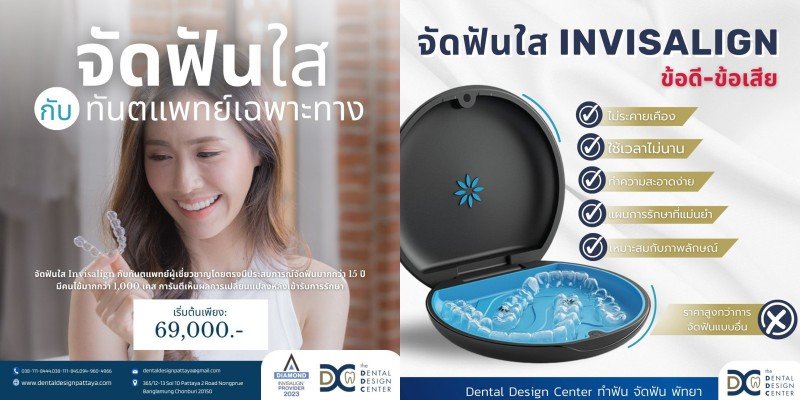 แนะนำ 5 คลินิกจัดฟันใส พัทยา มาตรฐานสากล ปรึกษาจัดฟันใสฟรี แนะนำ 5 คลินิกจัดฟันใส พัทยา มาตรฐานสากล ปรึกษาจัดฟันใสฟรี