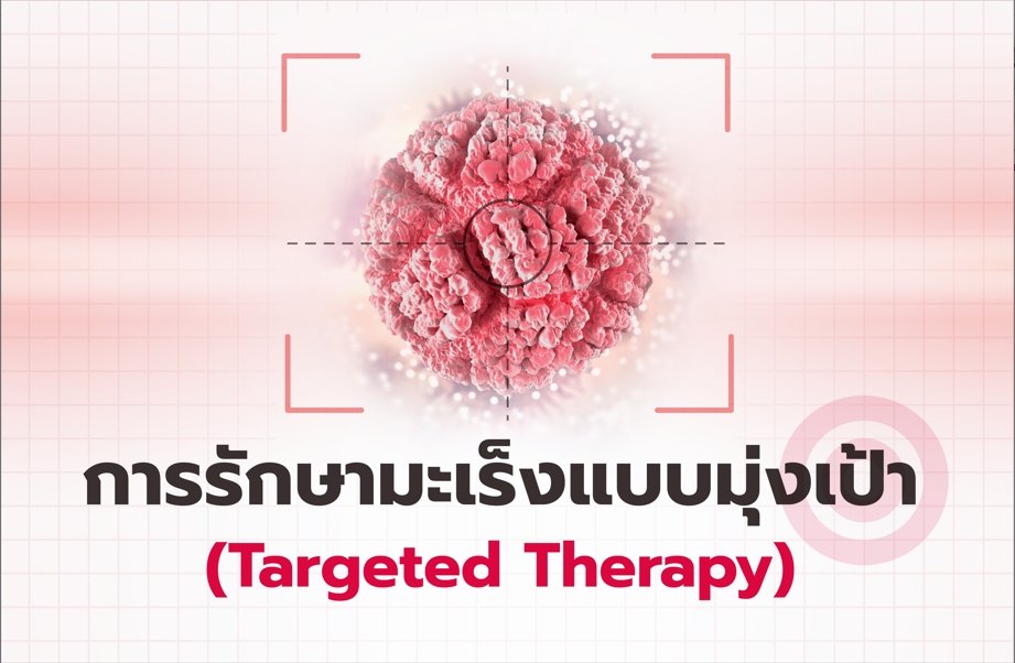 การรักษามะเร็งแบบมุ่งเป้า ( Targeted Therapy)