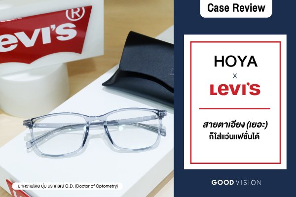 Case Review | EP.15 สายตาเอียง (เยอะ) ก็ใส่แว่นแฟชั่นได้!