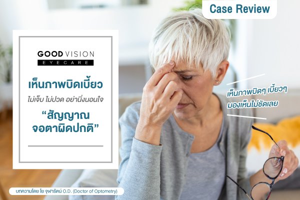 Case Review | EP.20 เห็นภาพบิดเบี้ยว ไม่เจ็บ ไม่ปวด อย่านิ่งนอนใจ สัญญาณจอตาผิดปกติ