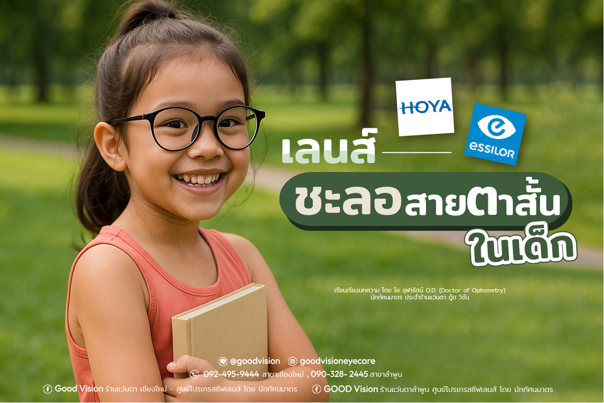 เลนส์ชะลอสายตาสั้นในเด็ก
