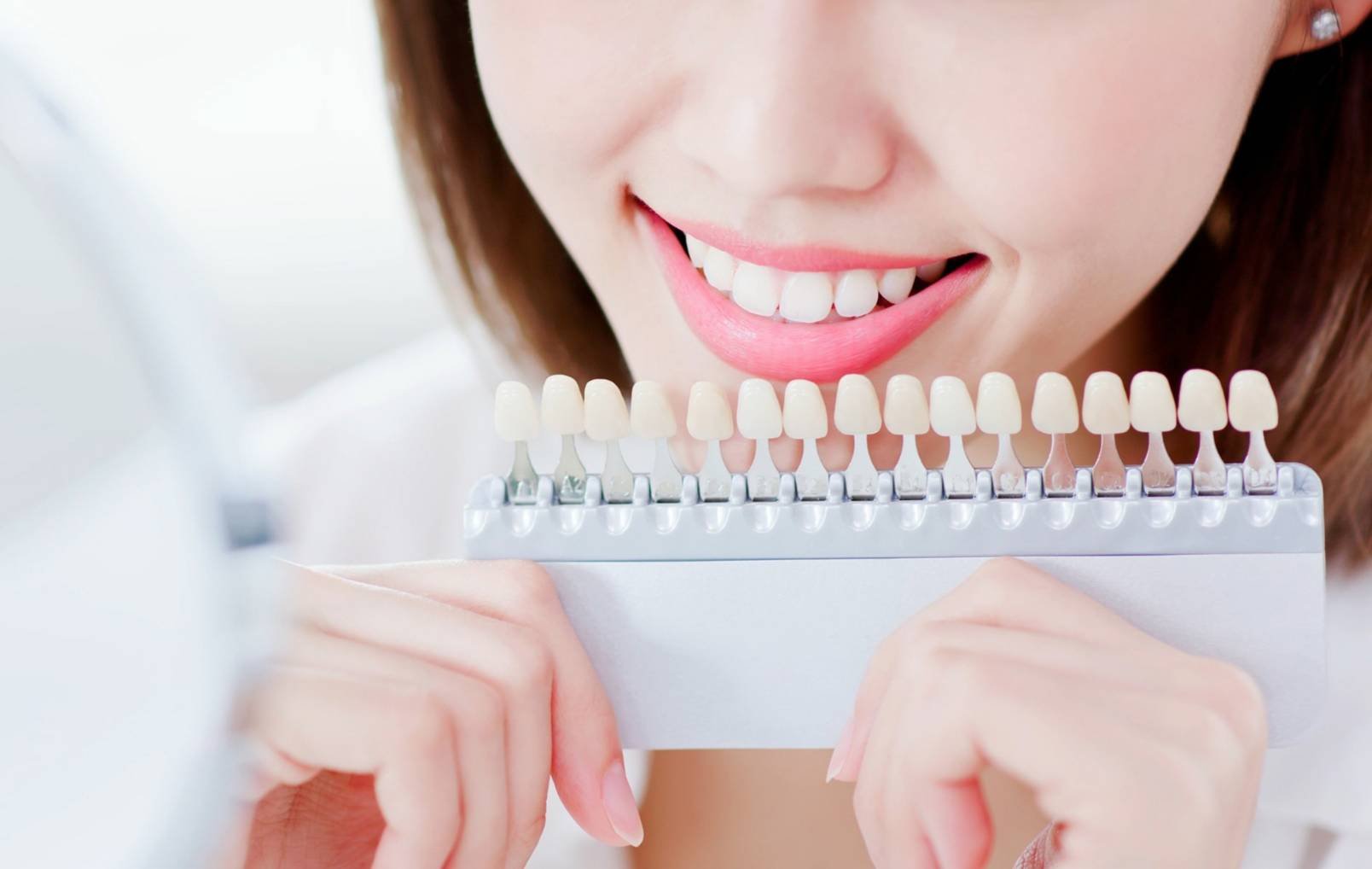 เตือนอันตราย! การเลือกใช้ผลิตภัณฑ์ และวิธีฟอกสีฟันที่ไม่ได้มาตรฐาน เตือนอันตราย! การเลือกใช้ผลิตภัณฑ์ และวิธีฟอกสีฟันที่ไม่ได้มาตรฐาน