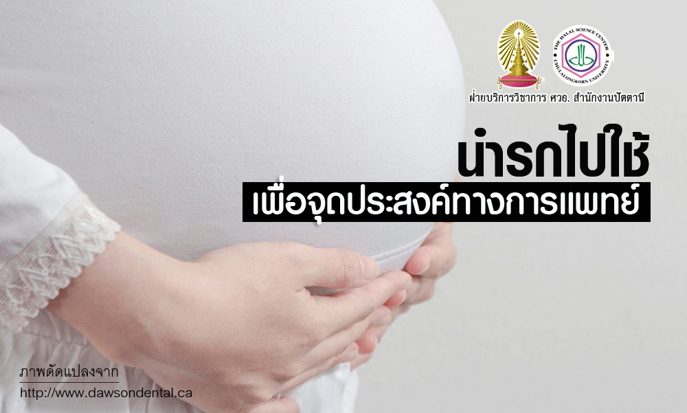 นำรกไปใช้เพื่อจุดประสงค์ทางการแพทย์