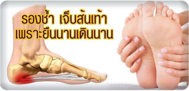 วิธีรักษาให้ลาขาด " รองช้ำ เจ็บส้นเท้า เพราะยืนนานเดินนาน "