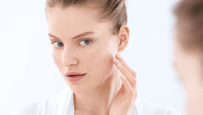 ผิวหน้าไหม้ ผิวหน้าไหม้