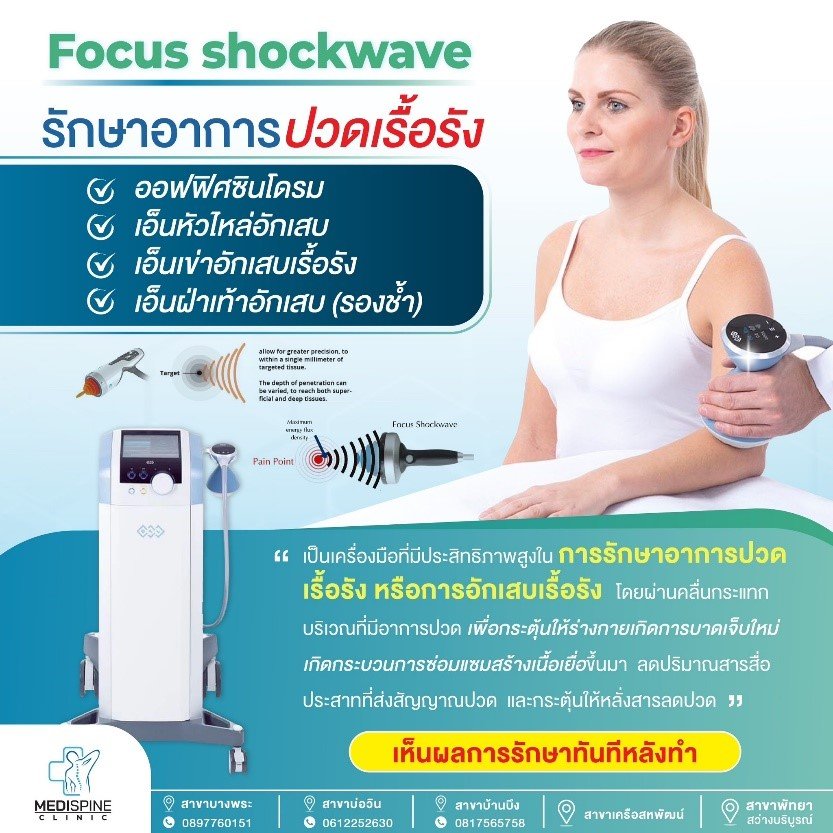 Focus Shockwave รักษาอาการปวดเรื้อรัง Focus Shockwave รักษาอาการปวดเรื้อรัง