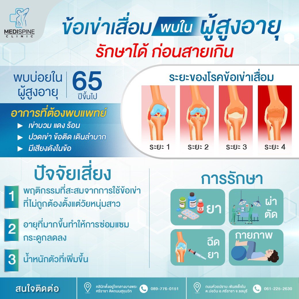 ข้อเข่าเสื่อม พบในผู้สูงอายุ รักษาได้ ก่อนสายเกิน