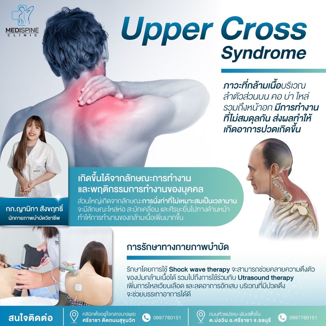 Upper Cross Syndrome ภาวะกล้ามเนื้อคอ บ่า ไหล่ ทำงานไม่สมดุล Upper Cross Syndrome ภาวะกล้ามเนื้อคอ บ่า ไหล่ ทำงานไม่สมดุล