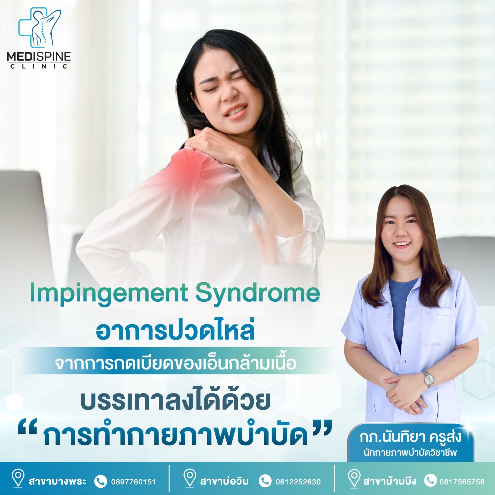 Impingement Syndrome อาการปวดไหล่ จากการกดเบียดของเอ็นกล้ามเนื้อ