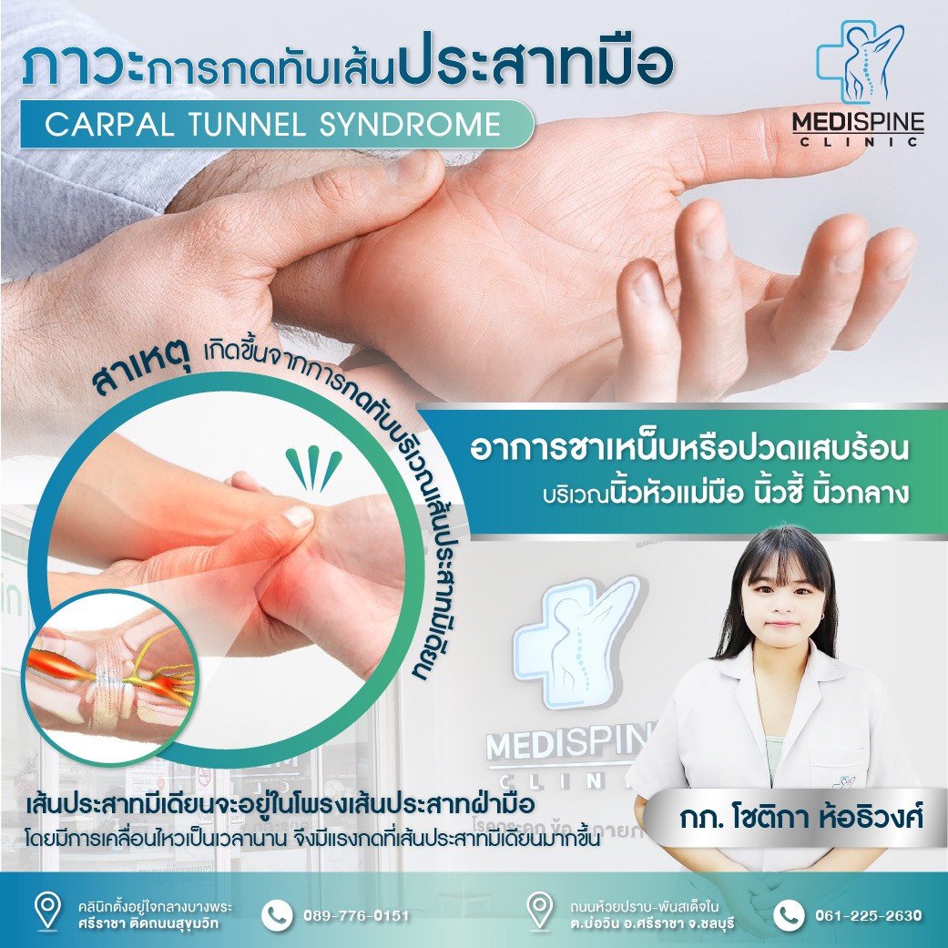ภาวะการกดทับเส้นประสาทมือ ภาวะการกดทับเส้นประสาทมือ