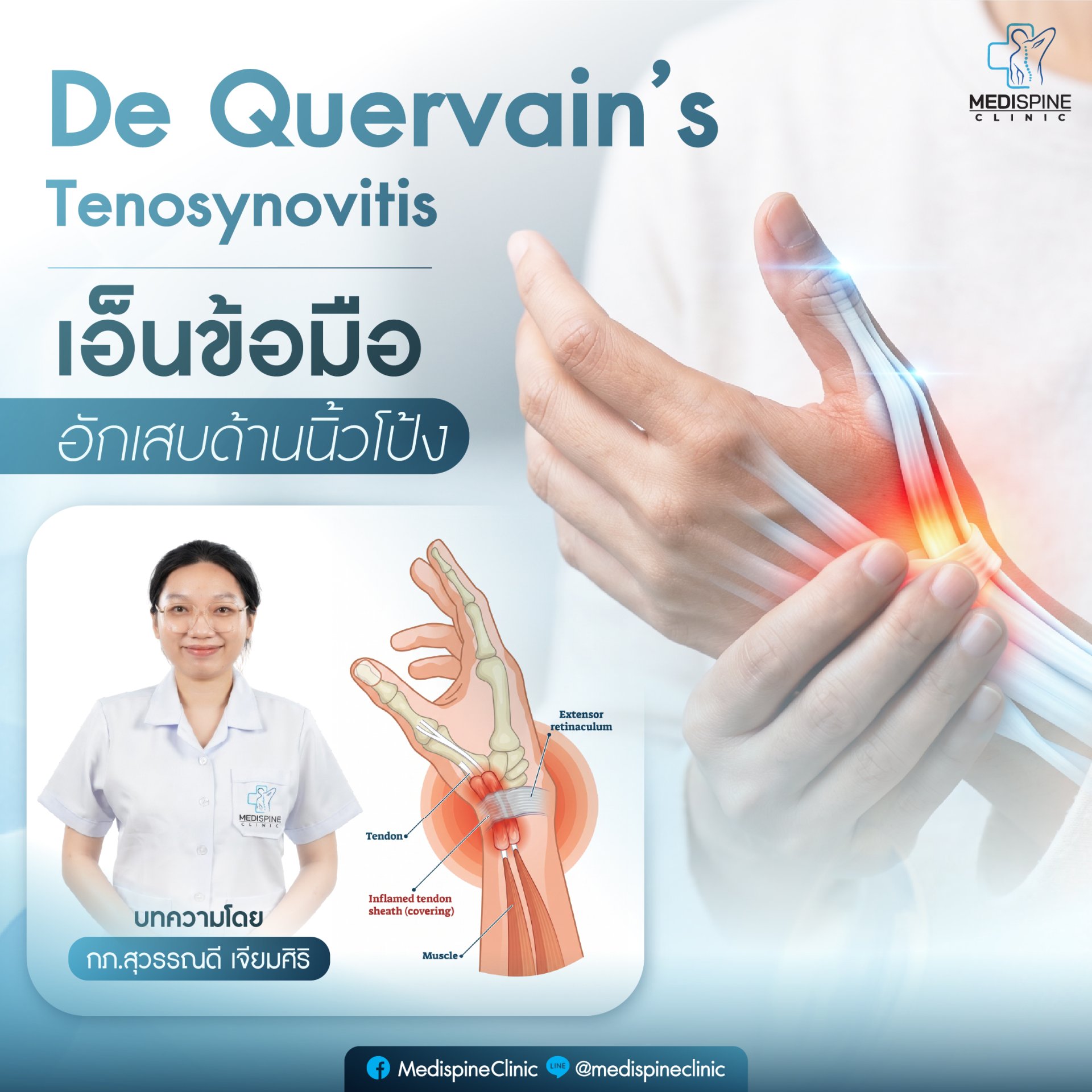 ปวดข้อมือด้านนิ้วโป้งระวัง! รู้จักโรคเดอกาแวง (De Quervain's Tenosynovitis) เอ็นข้อมืออักเสบที่คนยุคใหม่เป็นกันบ่อย