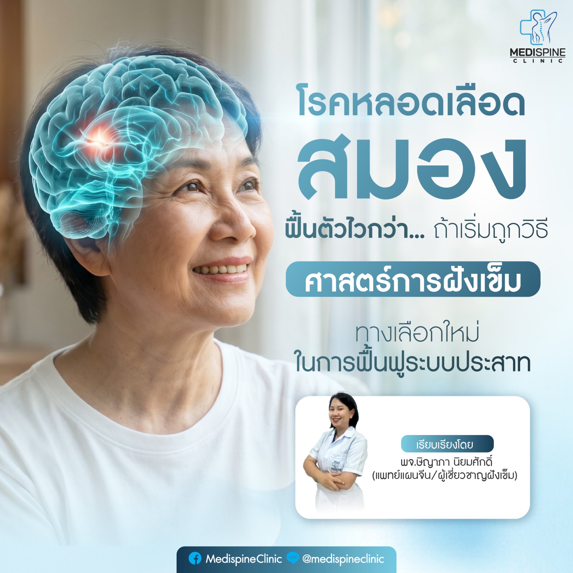 โรคหลอดเลือดสมอง ทำอย่างไรให้ฟื้นตัวได้เร็ว? เคล็ดลับกู้คืนร่างกายในช่วงเวลาทอง