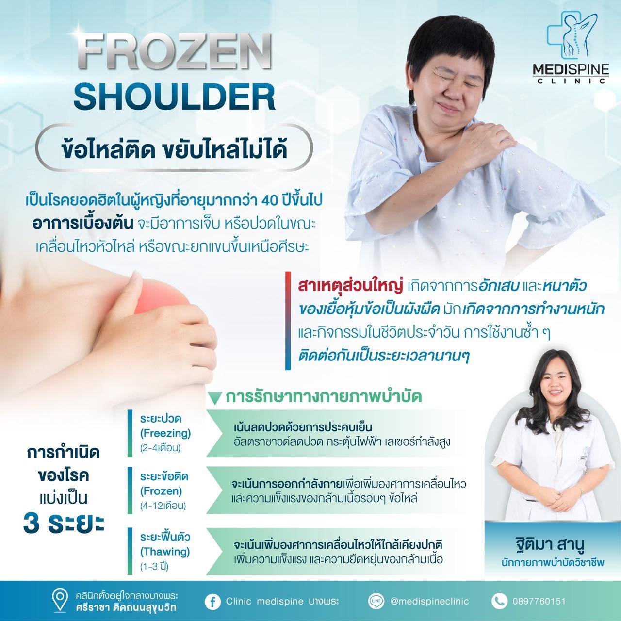 ข้อไหล่ติด ขยับไหล่ไม่ได้ หรือ Frozen shoulder