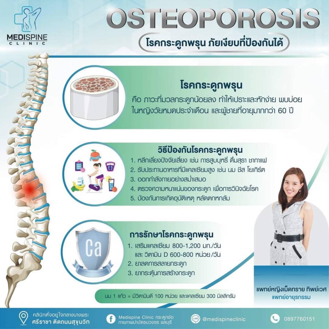 โรคกระดูกพรุน ภัยเงียบที่ป้องกันได้