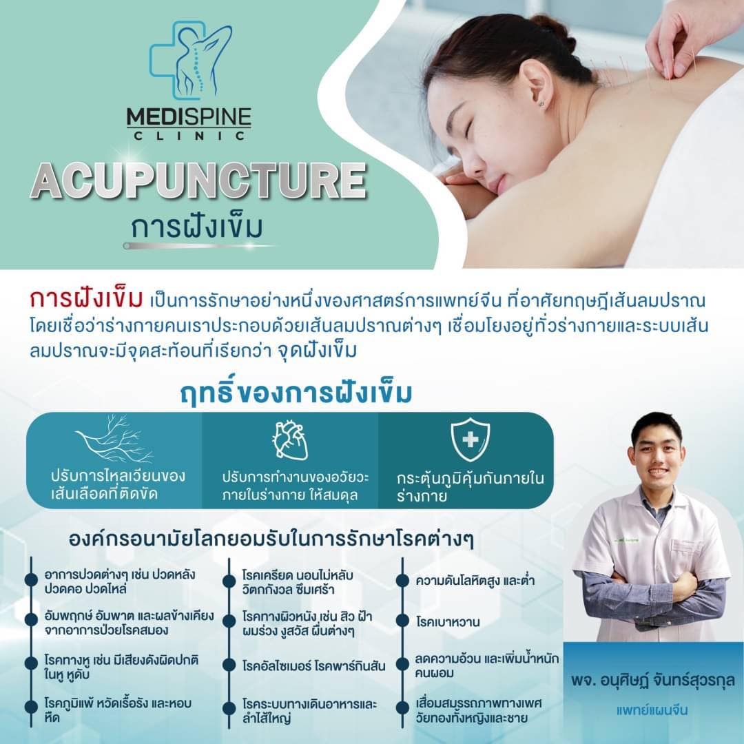 ศาสตร์แห่งการฝังเข็ม