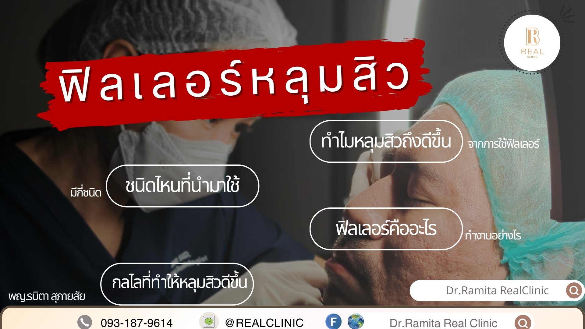 juvgen ดร.จิน หลุมสิวเกาหลี real scar synergy รักษาหลุมสิว