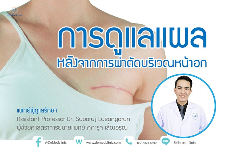 การดูแลแผลหลังจากการผ่าตัดบริเวณหน้าอก การดูแลแผลหลังจากการผ่าตัดบริเวณหน้าอก