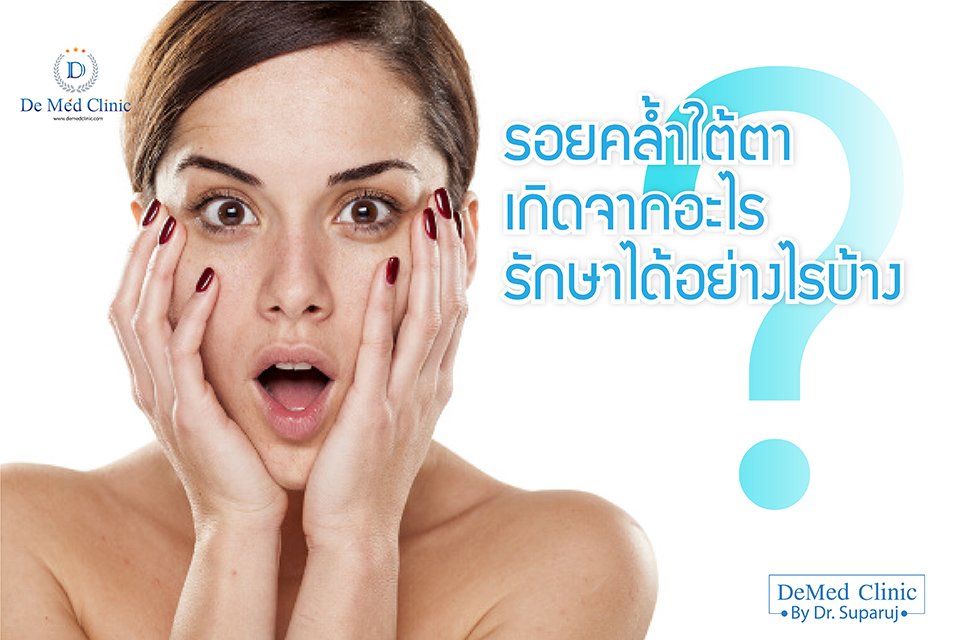 รอยคล้ำใต้ตา เกิดจากอะไรรักษาได้อย่างไรบ้าง รอยคล้ำใต้ตา เกิดจากอะไรรักษาได้อย่างไรบ้าง