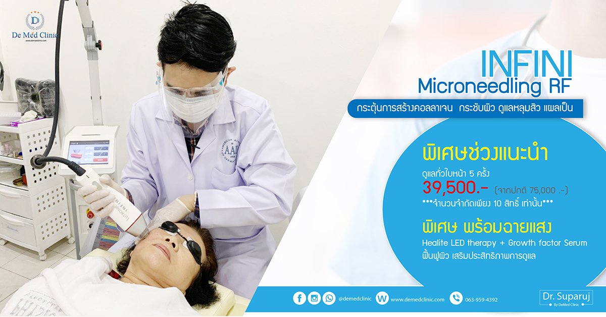 INFINI Microneedling RF กระตุ้นการสร้างคอลลาเจน กระชับผิว ดูแลหลุมสิว แผลเป็น พิเศษช่วงแนะนำ ดูแลทั่วไปหน้า 5 ครั้ง 39,500 บ. (จากปกติ 75,000 บ.) ***จำนวนจำกัดเพียง 10 สิทธิ์ เท่านั้น*** INFINI Microneedling RF กระตุ้นการสร้างคอลลาเจน กระชับผิว ดูแลหลุมสิว แผลเป็น พิเศษช่วงแนะนำ ดูแลทั่วไปหน้า 5 ครั้ง 39,500 บ. (จากปกติ 75,000 บ.) ***จำนวนจำกัดเพียง 10 สิทธิ์ เท่านั้น***