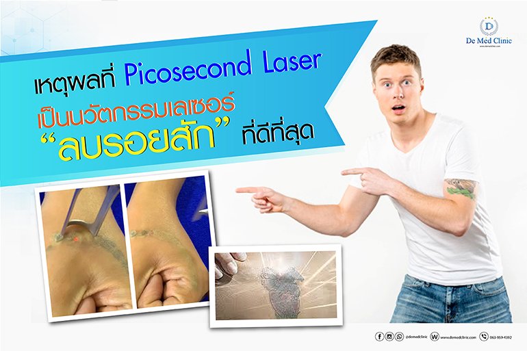 ลบรอยสัก อย่างมีประสิทธิภาพด้วยPicosecond Laser ***พิเศษ เริ่มต้น 1,000 บาท*** ลบรอยสัก อย่างมีประสิทธิภาพด้วยPicosecond Laser ***พิเศษ เริ่มต้น 1,000 บาท***