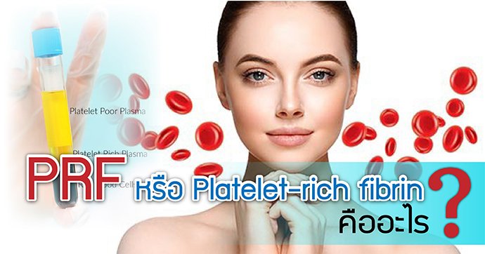 PRF หรือ Platelet-rich fibrin คืออะไร ? PRF หรือ Platelet-rich fibrin คืออะไร ?