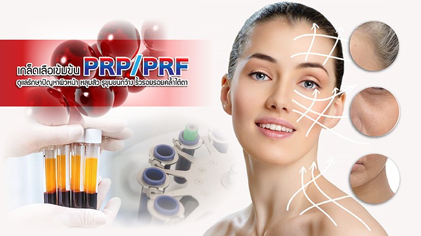 ดูแลรักษาปัญหาผิวหน้า หลุมสิว รูขุมขนกว้าง ริ้วรอยรอยคล้ำใต้ตาด้วย เกล็ดเลือเข้มข้น ชนิดพิเศษ PRP/PRF  ดูแลรักษาปัญหาผิวหน้า หลุมสิว รูขุมขนกว้าง ริ้วรอยรอยคล้ำใต้ตาด้วย เกล็ดเลือเข้มข้น ชนิดพิเศษ PRP/PRF