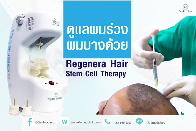 ดูแลผมร่วง ผมบางด้วย Regenera Hair Stem Cell Therapy !! ดูแลผมร่วง ผมบางด้วย Regenera Hair Stem Cell Therapy !!