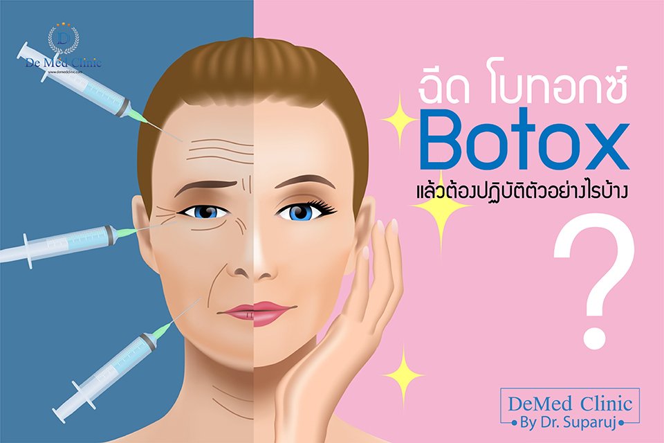 ฉีด โบทอกซ์ Botox แล้วต้องปฏิบัติตัวอย่างไรบ้าง ? ฉีด โบทอกซ์ Botox แล้วต้องปฏิบัติตัวอย่างไรบ้าง ?