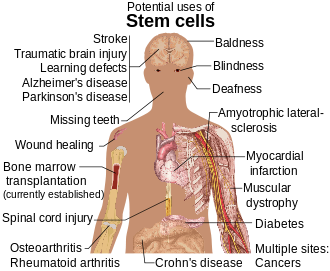 What is stem cell therapy??? 