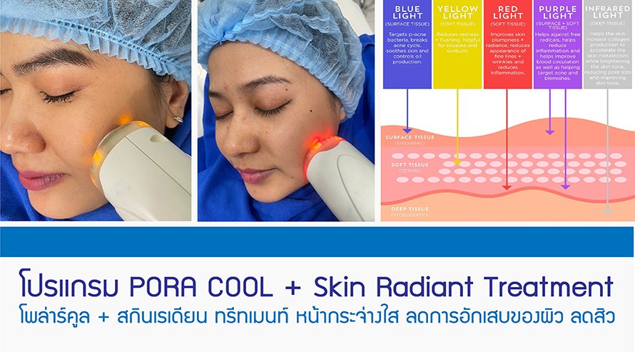โปรแกรม PORA COOL + Skin Radiant Treatment โพล่าร์คูล + สกินเรเดียน ทรีทเมนท์ หน้ากระจ่างใส ลดการอักเสบของผิว ลดสิว โปรแกรม PORA COOL + Skin Radiant Treatment โพล่าร์คูล + สกินเรเดียน ทรีทเมนท์ หน้ากระจ่างใส ลดการอักเสบของผิว ลดสิว