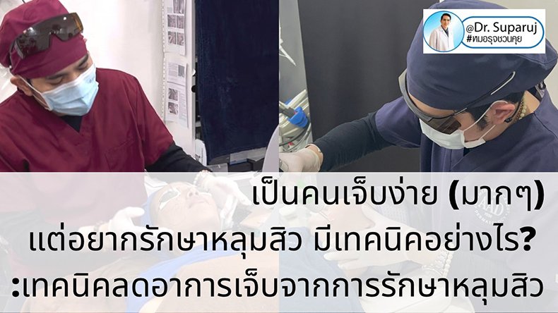 เป็นคนเจ็บง่าย (มากๆ) แต่อยากรักษาหลุมสิว มีเทคนิคอย่างไร? : เทคนิคลดอาการเจ็บจากการรักษาหลุมสิว เป็นคนเจ็บง่าย (มากๆ) แต่อยากรักษาหลุมสิว มีเทคนิคอย่างไร? : เทคนิคลดอาการเจ็บจากการรักษาหลุมสิว