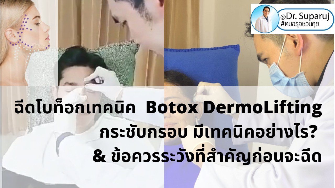 ฉีดโบท็อกเทคนิค Botox DermoLifting กระชับกรอบหน้า มีเทคนิคอย่างไร? & ข้อควรระวังที่สำคัญก่อนฉีด ฉีดโบท็อกเทคนิค Botox DermoLifting กระชับกรอบหน้า มีเทคนิคอย่างไร? & ข้อควรระวังที่สำคัญก่อนฉีด