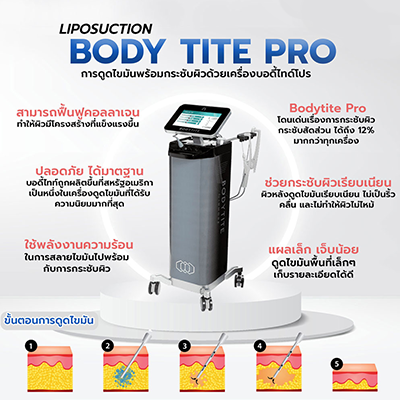 ดูดไขมันด้วยเครื่อง Bodytite pro