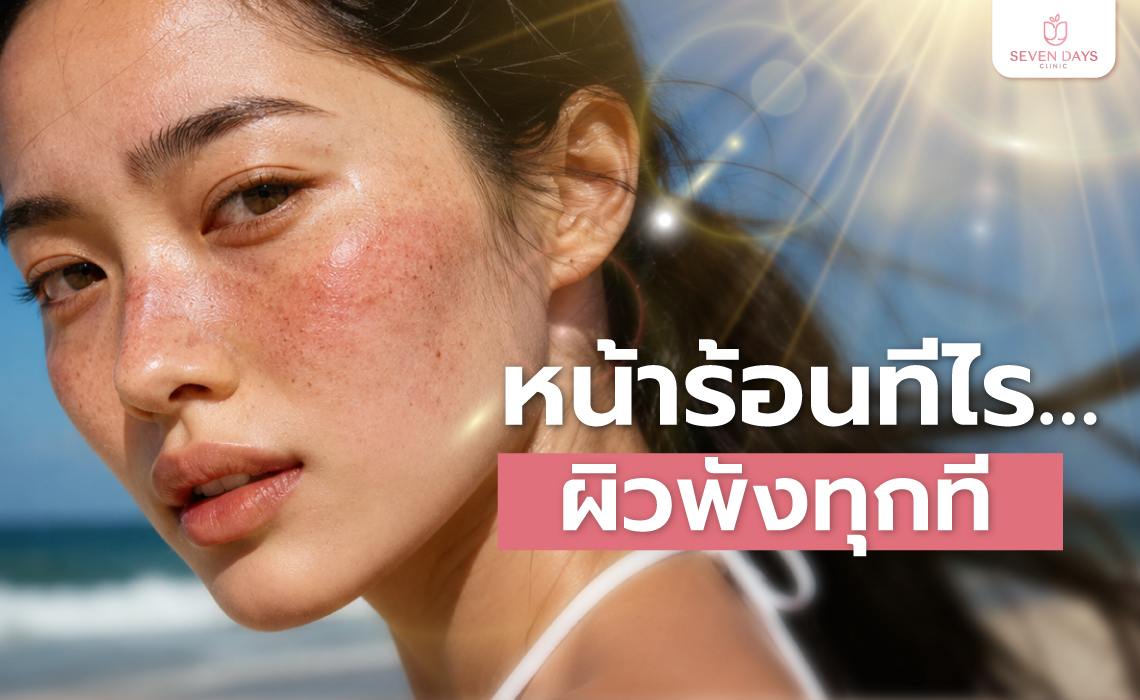 หน้าร้อนทีไรผิวพังทุกที 