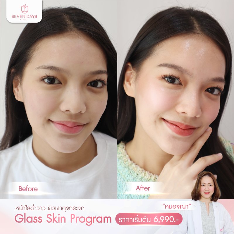 รีวิว Glass Skin