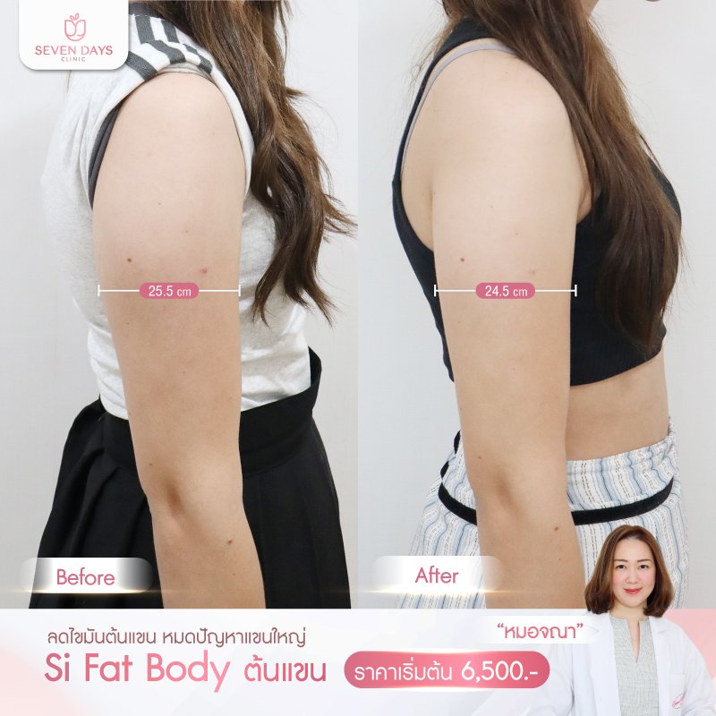 รีวิว Fat Body