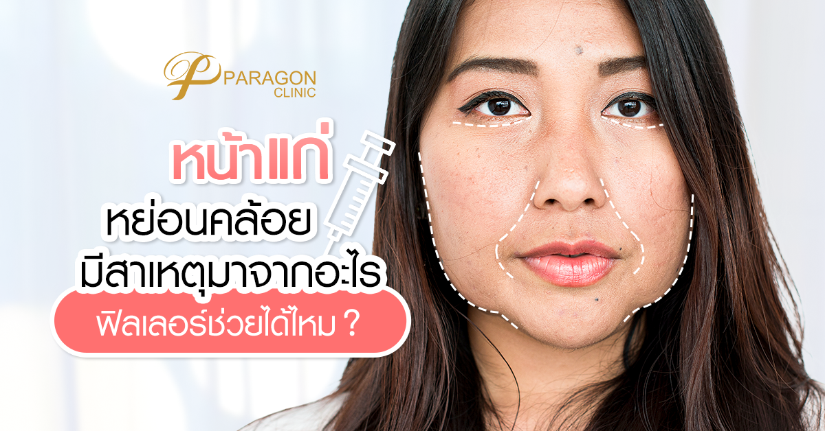 หน้าแก่ ? หย่อนคล้อย ? มีสาเหตุมาจากอะไร ? ฟิลเลอร์ช่วยได้ไหม?