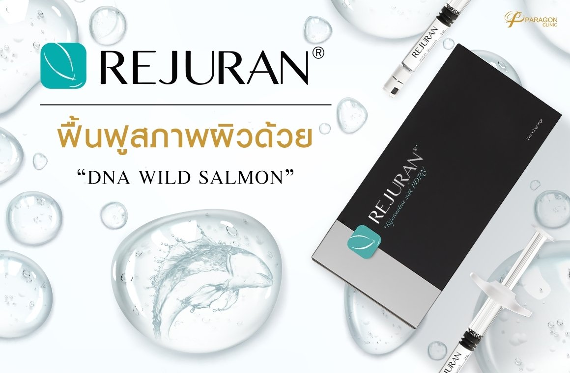 Rejuran ฟื้นฟูผิวอย่างเร่งด้วย DNA Wild salmon