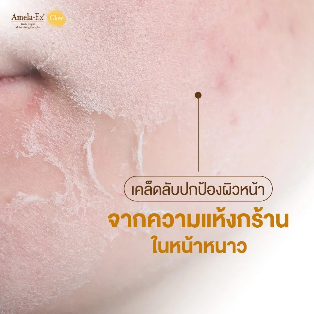 เคล็ดลับปกป้องผิวหน้าจากความแห้งกร้านในหน้าหนาว