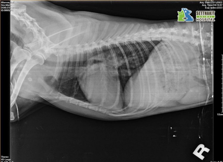 ถ่ายภาพเอกซเรย์ช่องอก (X-ray)