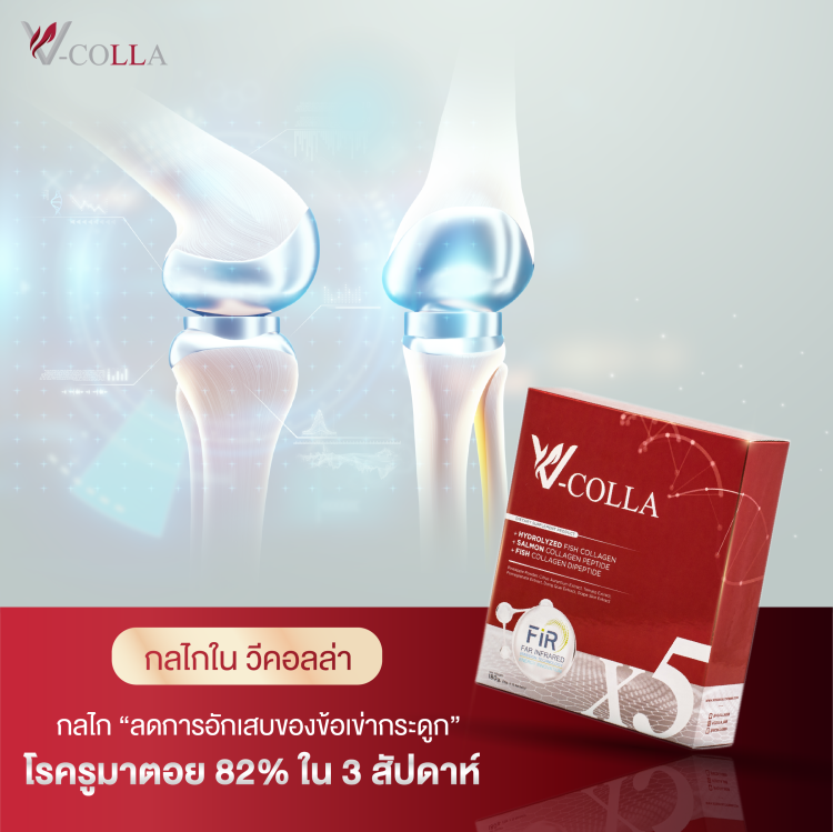 รูมาตอย ข้อ เข่า กระดูกอักเสบ