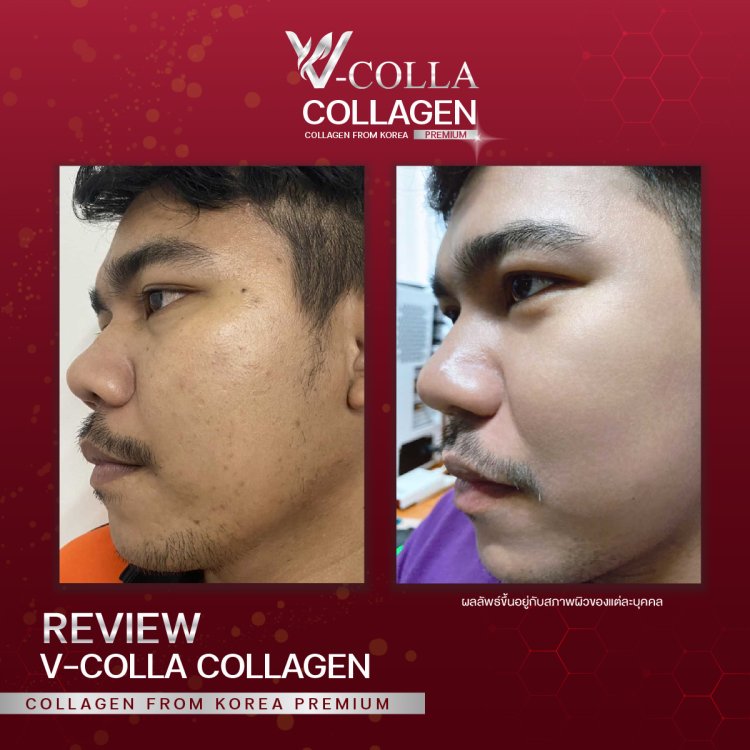 สูบบุหรี่จัด