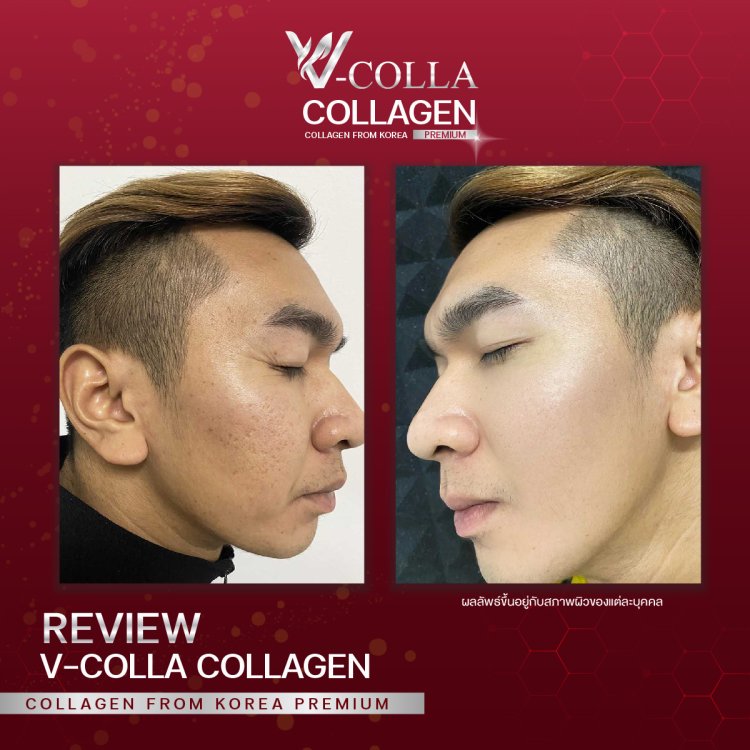 กระชับรูขุมขน