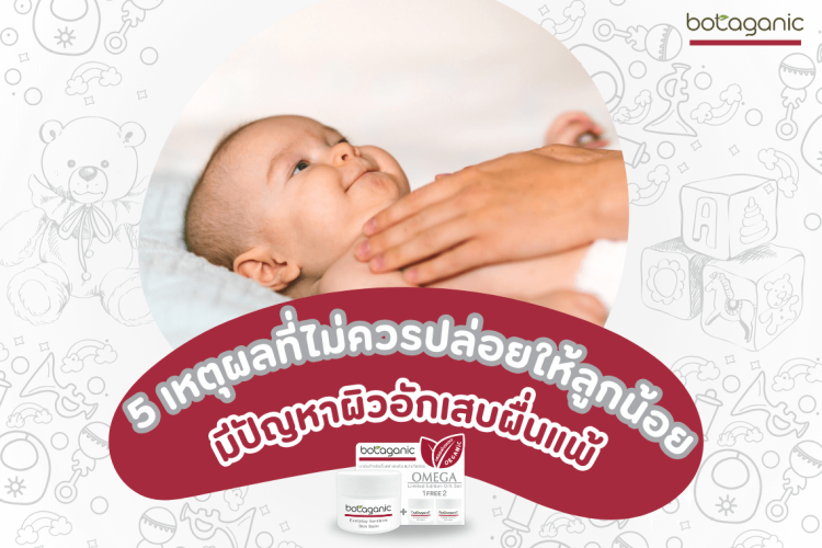 โบทาแกนิค บาล์ม บาล์ทาผิวเด็ก บาล์มแก้ผดผื่น บาล์มแก้คัน ผื่นแพ้ แมลงกัดต่อย ออร์แกนิก โอเมก้าบาล์ม บาล์แก้แพ้ ผิวบอบบาง ผิวทารก ผู้ป่วยติดเตียง ผื่นแดงคัน โบทาแกนิก โอเมก้าบาล์ม โอเมก้า 3 6 9