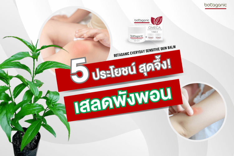 เสลดพังพอน ประโยชน์ บาล์มเสลดพังพอน บาล์มแก้คัน โบทาแกนิก โบทาแกนิค บาล์มทาผิวเด็ก ผดผื่น ผื่นแพ้ ยุงกัด แพ้น้ำลายยุง ผดผื่นแดงคัน
