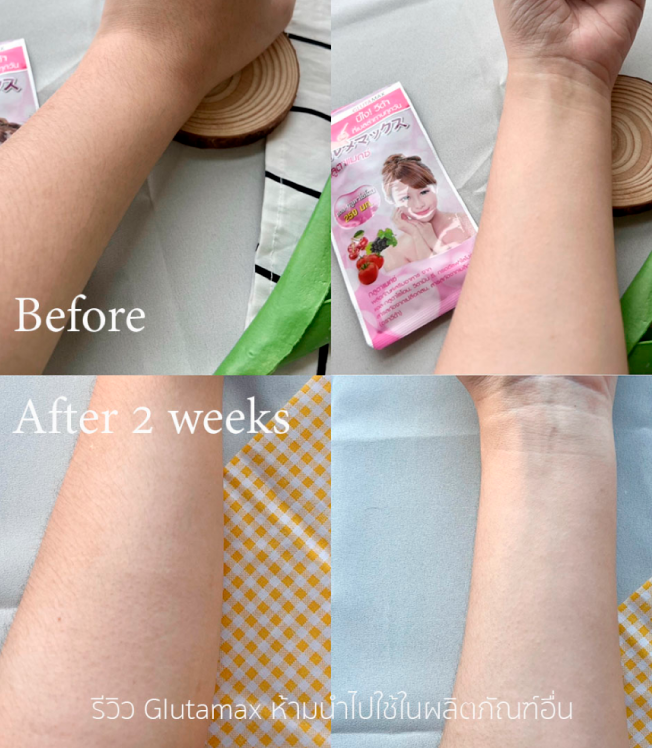 วีด้า เบลล่า ราณี VIDA GlutaMax ผิวขาว สวย กระจ่างใส ลดสิว ลดจุดด่างดำ กลูตาแม็กซ์ กลูต้า บำรุงผิว อาหารเสริม